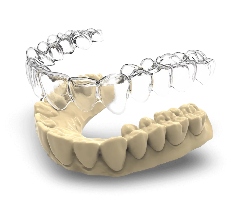 invisalign